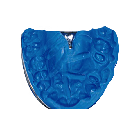 DEI® Rainbow Putty Regular after setting in the mouth.