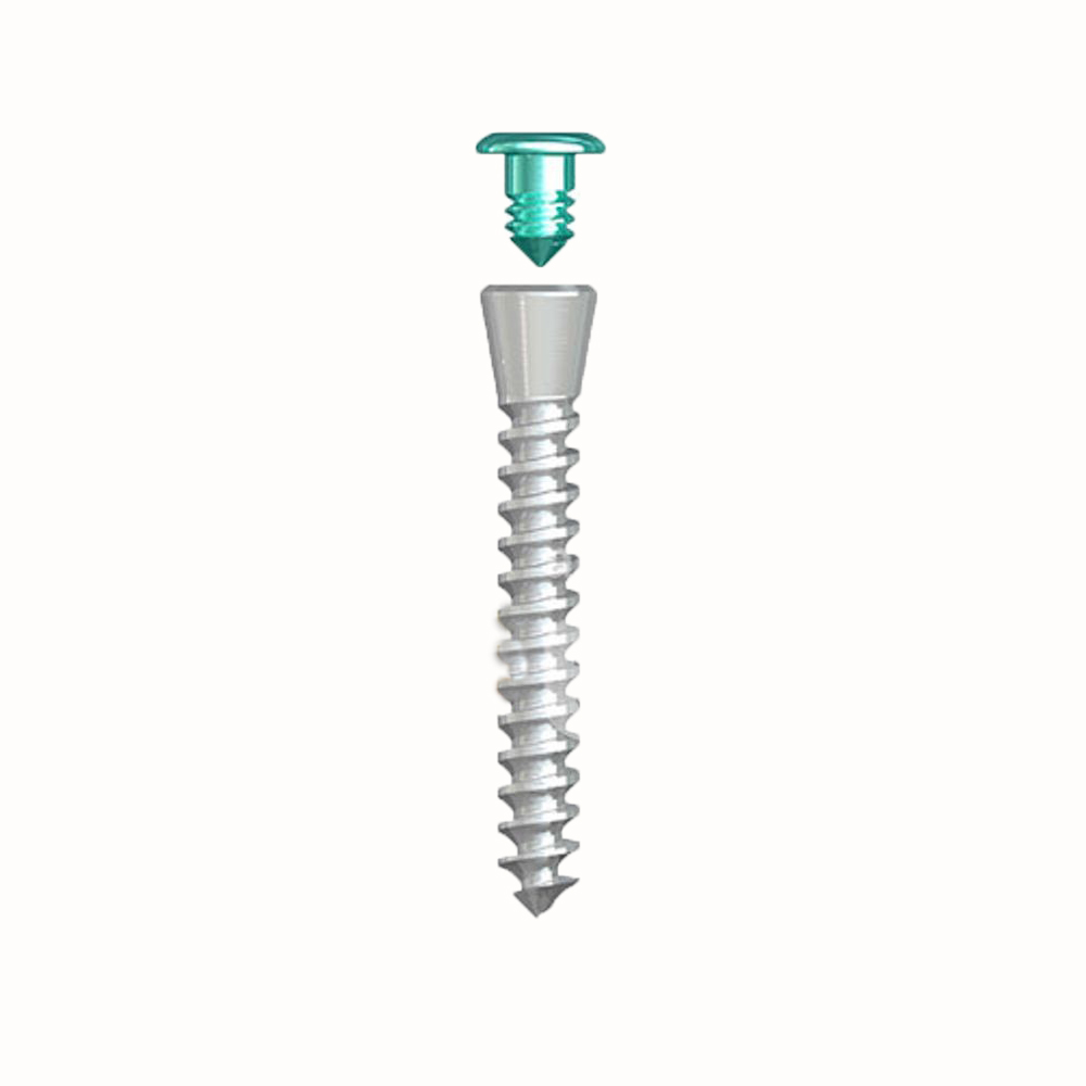 Tent Screw